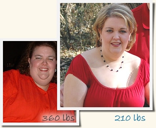 Kaci Roux-en-Y Gastric Bypass