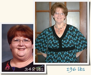 Karen Roux-en-Y Gastric Bypass